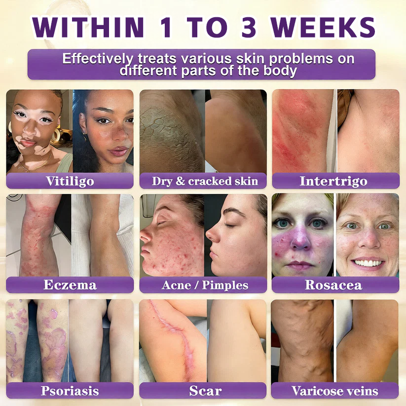 🔥LAST DAY 50% OFF - Mentalku® Biotin 10-in-1 Skin Restoration Cream