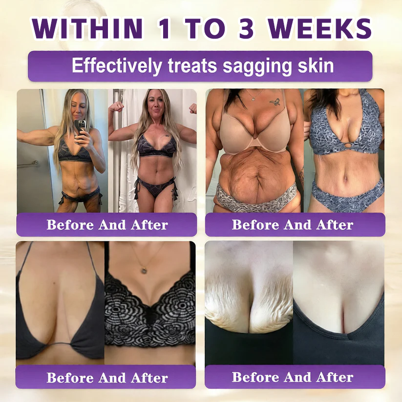 🔥LAST DAY 50% OFF - Mentalku® Biotin 10-in-1 Skin Restoration Cream
