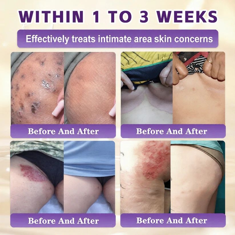 🔥LAST DAY 50% OFF - Mentalku® Biotin 10-in-1 Skin Restoration Cream