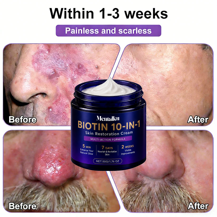 🔥LAST DAY 50% OFF - Mentalku® Biotin 10-in-1 Skin Restoration Cream