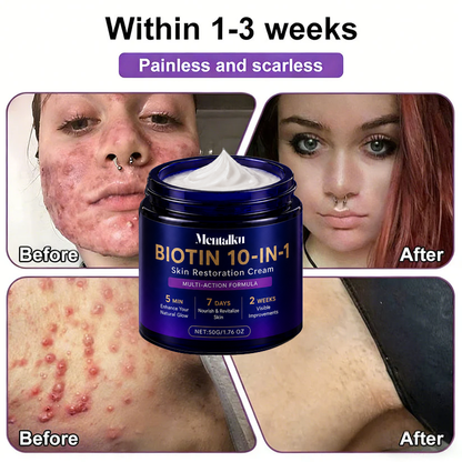 🔥LAST DAY 50% OFF - Mentalku® Biotin 10-in-1 Skin Restoration Cream