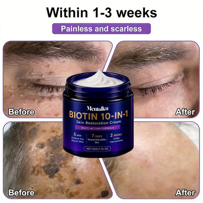🔥LAST DAY 50% OFF - Mentalku® Biotin 10-in-1 Skin Restoration Cream