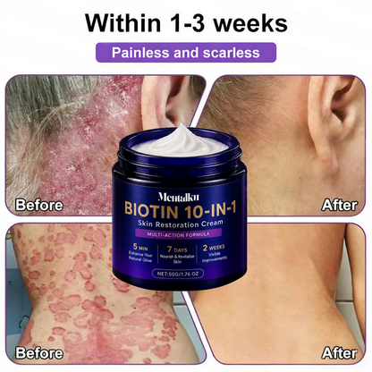🔥LAST DAY 50% OFF - Mentalku® Biotin 10-in-1 Skin Restoration Cream